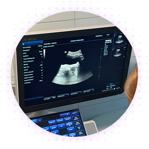 УЗИ молочных желез