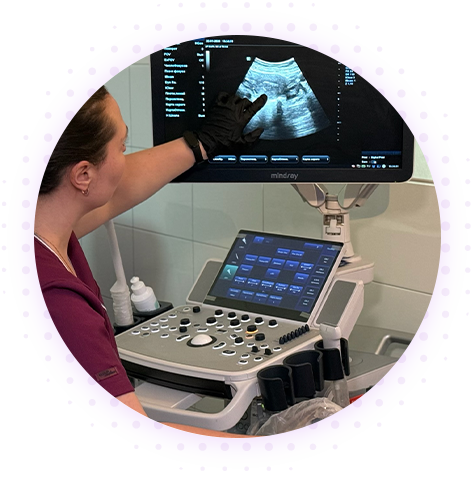 УЗИ селезенки