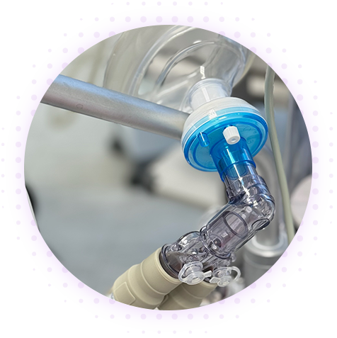 Мягкая инфильтрационная анестезия