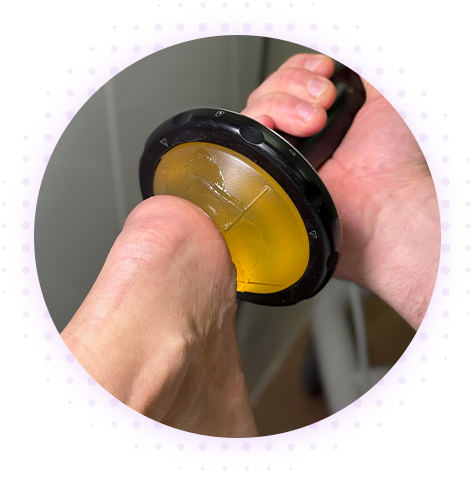 Ударно-волновая терапия (УВТ)