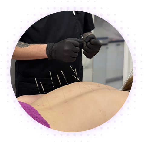 Корпоральное углоукалывание