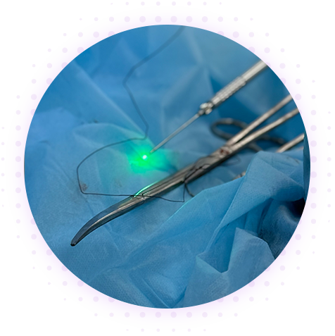 Эпителиальный копчиковый ход