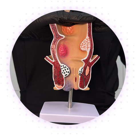 Эстетическая проктология