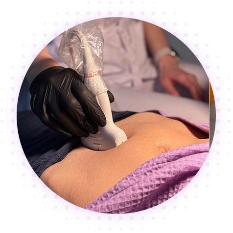 УЗИ малого таза