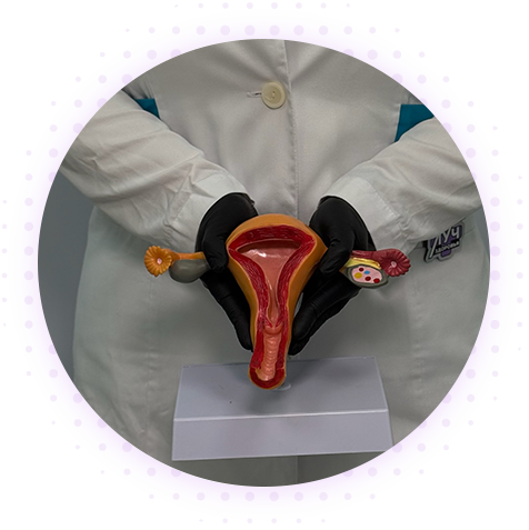 Миома матки