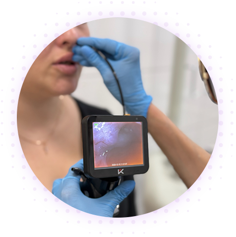 Удаление полипов носа